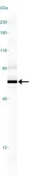 Anti-SMAD6 antibody used in Western Blot (WB). GTX13727