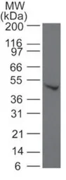 Anti-SMAD6 antibody used in Western Blot (WB). GTX13727