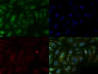 Anti-SMAD6 antibody used in Immunocytochemistry/ Immunofluorescence (ICC/IF). GTX13727
