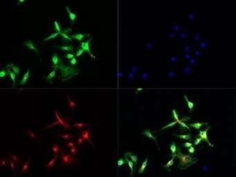 Anti-TLR7 antibody used in Immunocytochemistry/ Immunofluorescence (ICC/IF). GTX13730
