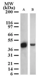 Anti-SETD7 antibody used in Western Blot (WB). GTX13731