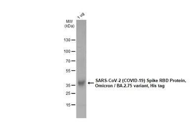 SARS-CoV-2 (COVID-19) Spike RBD Protein, Omicron / BA.2.75 variant, His tag. GTX137422-pro