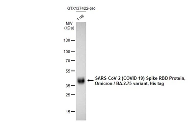 SARS-CoV-2 (COVID-19) Spike RBD Protein, Omicron / BA.2.75 variant, His tag. GTX137422-pro
