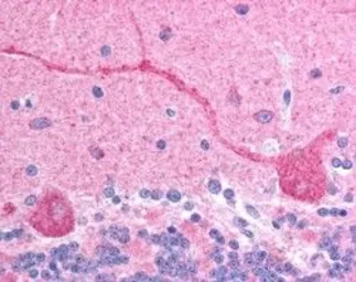 Anti-CHFR antibody, C-term used in IHC (Paraffin sections) (IHC-P). GTX13773
