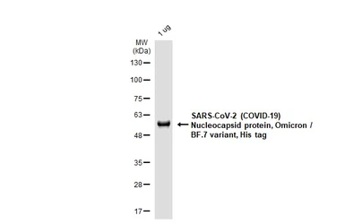 SARS-CoV-2 (COVID-19) Nucleocapsid protein, Omicron / BF.7 variant, His tag. GTX137882-pro