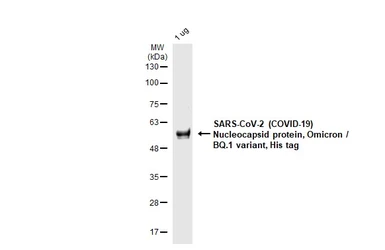 SARS-CoV-2 (COVID-19) Nucleocapsid protein, Omicron / BQ.1 variant, His tag. GTX137883-pro