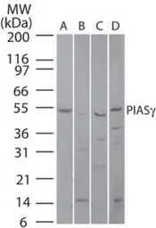 Anti-PIASy antibody used in Western Blot (WB). GTX13795