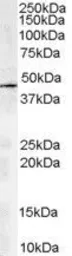 Anti-ACTR1A antibody, C-term used in Western Blot (WB). GTX13796