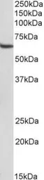 Anti-STAM antibody [29C678] used in Western Blot (WB). GTX13797