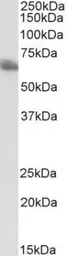 Anti-TEM8 antibody [200C1339(SB20)] used in Western Blot (WB). GTX13798