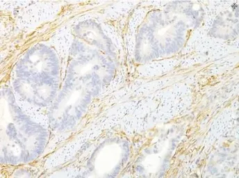 Anti-TEM8 antibody [200C1339(SB20)] used in IHC (Paraffin sections) (IHC-P). GTX13798