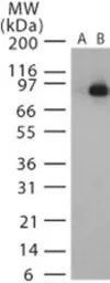 Anti-Bacillus anthracis Lethal Factor antibody used in Western Blot (WB). GTX13805