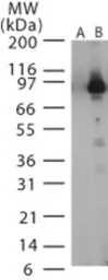 Anti-Bacillus anthracis Lethal Factor antibody used in Western Blot (WB). GTX13806