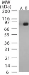 Anti-Bacillus anthracis Lethal Factor antibody used in Western Blot (WB). GTX13807