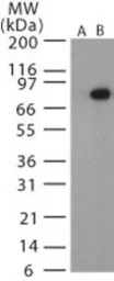 Anti-Bacillus anthracis protective antigen antibody used in Western Blot (WB). GTX13809