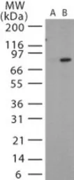 Anti-Bacillus anthracis protective antigen antibody used in Western Blot (WB). GTX13809