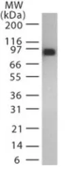Anti-Bacillus anthracis Lethal Factor antibody [5F502.2] used in Western Blot (WB). GTX13814