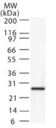Anti-Diablo antibody used in Western Blot (WB). GTX13817