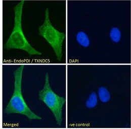 Anti-TXNDC5 antibody, C-term used in Immunocytochemistry/ Immunofluorescence (ICC/IF). GTX13820
