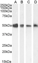Anti-TXNDC5 antibody, C-term used in Western Blot (WB). GTX13820