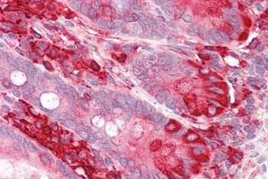 Anti-TXNDC5 antibody, C-term used in IHC (Paraffin sections) (IHC-P). GTX13820