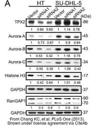 Anti-Aurora A antibody [35C1] used in Western Blot (WB). GTX13824