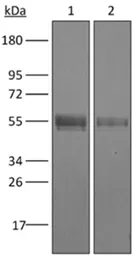 Anti-CD4 antibody [YTS177] used in Western Blot (WB). GTX13846