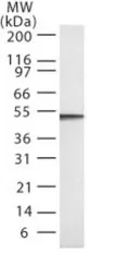 Anti-Caspase 2 antibody [18E809.3] used in Western Blot (WB). GTX13870