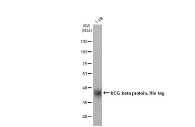 hCG beta protein, His tag. GTX138833-pro