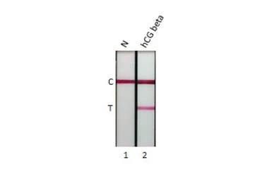 hCG beta protein, His tag. GTX138833-pro