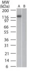 Anti-DNMT3A antibody [64B814.1] used in Western Blot (WB). GTX13887