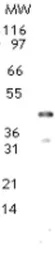 Anti-DNMT2 antibody used in Western Blot (WB). GTX13892