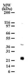 Anti-MD1 antibody used in Western Blot (WB). GTX13894