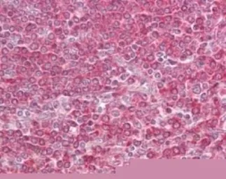 Anti-MD1 antibody used in IHC (Paraffin sections) (IHC-P). GTX13894