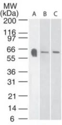 Anti-5-HT3A receptor antibody used in Western Blot (WB). GTX13897