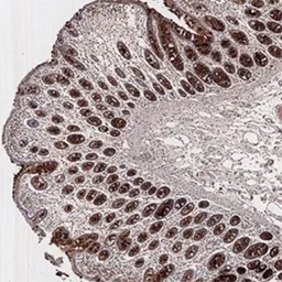 Anti-PMS2 antibody [163C1251] used in IHC (Paraffin sections) (IHC-P). GTX13900