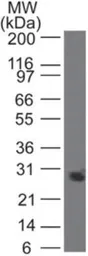 Anti-PGRPS antibody [188C424] used in Western Blot (WB). GTX13903