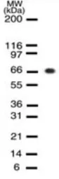 Anti-Rb cleaved antibody [172C1094] used in Western Blot (WB). GTX13905