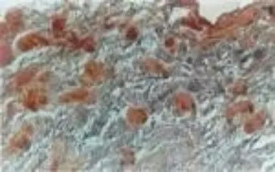 Anti-NIFK antibody used in IHC (Paraffin sections) (IHC-P). GTX13912
