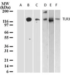 Anti-TLR3 antibody [40C1285.6] used in Western Blot (WB). GTX13915