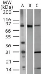 Anti-TLR2 antibody used in Western Blot (WB). GTX13930