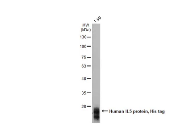 Human IL5 protein, His tag. GTX139317-pro