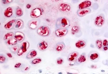 Anti-ADAMTS5 antibody used in IHC (Paraffin sections) (IHC-P). GTX13976
