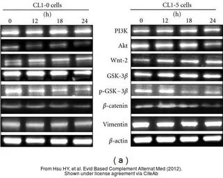 Anti-AKT antibody used in Western Blot (WB). GTX13990