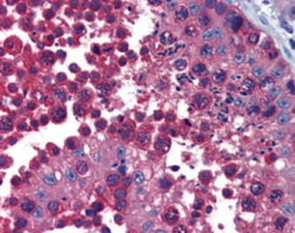 Anti-TCP1 beta antibody [4E217] used in IHC (Paraffin sections) (IHC-P). GTX14137