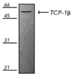 Anti-TCP1 beta antibody [4E217] used in Western Blot (WB). GTX14137
