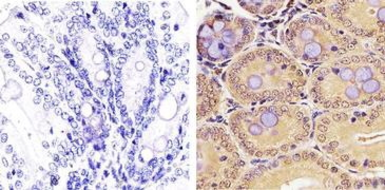 Anti-PLK1 antibody [Mixed clones] used in IHC (Paraffin sections) (IHC-P). GTX14210