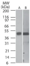 Anti-Caspase 1 antibody [14F468] used in Western Blot (WB). GTX14367