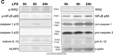 Anti-Caspase 1 antibody [14F468] used in Western Blot (WB). GTX14367