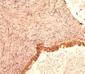 Anti-Caspase 1 antibody [14F468] used in IHC (Paraffin sections) (IHC-P). GTX14367